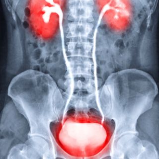 Poprawa przepływu moczu